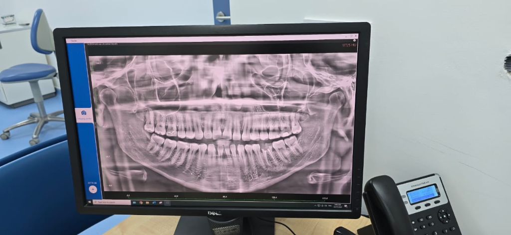 Radiographie panoramique dentaire 3D sur écran
